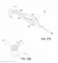 Fig. 24 - Methods and devices to treat nasal airways
