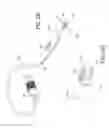 Fig. 37 - Methods and devices to treat nasal airways