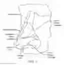 Fig. 02 - Methods and devices to treat nasal airways