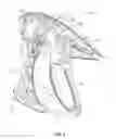 Fig. 04 - Surgical forceps capable of adjusting sealing pressure based on vessel size