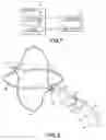 Fig. 02 - Apparatus for laser lithotripsy