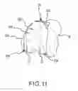 Fig. 23 - Arthroplasty jigs with mating accuracy