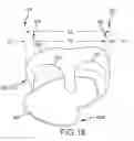Fig. 29 - Arthroplasty jigs with mating accuracy