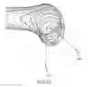 Fig. 37 - Arthroplasty jigs with mating accuracy