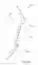 Fig. 43 - Arthroplasty jigs with mating accuracy