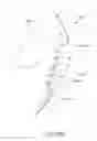 Fig. 45 - Arthroplasty jigs with mating accuracy