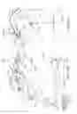 Fig. 52 - Arthroplasty jigs with mating accuracy