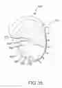 Fig. 55 - Arthroplasty jigs with mating accuracy