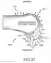 Fig. 57 - Arthroplasty jigs with mating accuracy