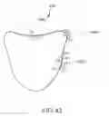 Fig. 66 - Arthroplasty jigs with mating accuracy