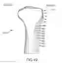Fig. 73 - Arthroplasty jigs with mating accuracy