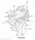 Fig. 76 - Arthroplasty jigs with mating accuracy
