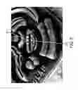 Fig. 06 - DUAL-MODE IMAGING SYSTEM FOR TRACKING AND CONTROL DURING MEDICAL PROCEDURES