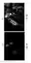 Fig. 07 - DUAL-MODE IMAGING SYSTEM FOR TRACKING AND CONTROL DURING MEDICAL PROCEDURES