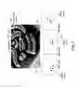 Fig. 08 - DUAL-MODE IMAGING SYSTEM FOR TRACKING AND CONTROL DURING MEDICAL PROCEDURES