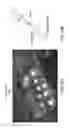 Fig. 14 - DUAL-MODE IMAGING SYSTEM FOR TRACKING AND CONTROL DURING MEDICAL PROCEDURES