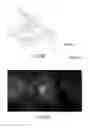 Fig. 22 - DUAL-MODE IMAGING SYSTEM FOR TRACKING AND CONTROL DURING MEDICAL PROCEDURES