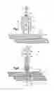 Fig. 03 - Robotic surgery