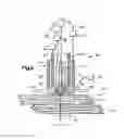 Fig. 04 - Robotic surgery