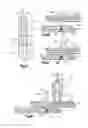 Fig. 09 - Robotic surgery