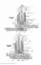 Fig. 10 - Robotic surgery