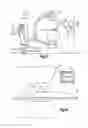 Fig. 16 - Robotic surgery