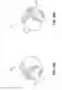 Fig. 16 - Surgical instrument