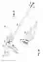 Fig. 17 - Surgical instrument