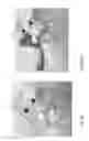 Fig. 07 - ACETABULAR CUP IMPACTING USING PATIENT-SPECIFIC INSTRUMENTATION