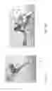Fig. 09 - ACETABULAR CUP IMPACTING USING PATIENT-SPECIFIC INSTRUMENTATION