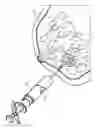 Fig. 01 - Biopsy site marker