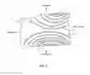 Fig. 05 - Surgical sterilization system and method