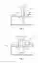 Fig. 08 - Surgical sterilization system and method