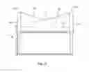 Fig. 10 - Surgical sterilization system and method