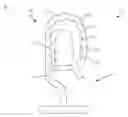 Fig. 01 - Surgical sterilization system and method