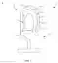 Fig. 02 - Surgical sterilization system and method
