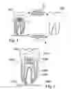 Fig. 02 - Methods of designing and manufacturing customized dental prosthesis for periodontal or osseointegration and related systems