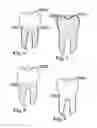 Fig. 06 - Methods of designing and manufacturing customized dental prosthesis for periodontal or osseointegration and related systems