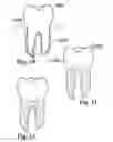 Fig. 07 - Methods of designing and manufacturing customized dental prosthesis for periodontal or osseointegration and related systems