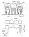 Fig. 11 - Methods of designing and manufacturing customized dental prosthesis for periodontal or osseointegration and related systems