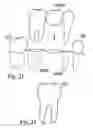 Fig. 12 - Methods of designing and manufacturing customized dental prosthesis for periodontal or osseointegration and related systems