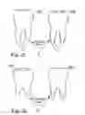 Fig. 13 - Methods of designing and manufacturing customized dental prosthesis for periodontal or osseointegration and related systems