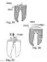 Fig. 16 - Methods of designing and manufacturing customized dental prosthesis for periodontal or osseointegration and related systems