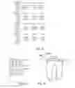 Fig. 17 - Methods of designing and manufacturing customized dental prosthesis for periodontal or osseointegration and related systems