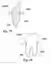 Fig. 20 - Methods of designing and manufacturing customized dental prosthesis for periodontal or osseointegration and related systems