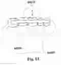 Fig. 40 - Methods of designing and manufacturing customized dental prosthesis for periodontal or osseointegration and related systems