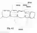 Fig. 41 - Methods of designing and manufacturing customized dental prosthesis for periodontal or osseointegration and related systems