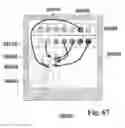 Fig. 46 - Methods of designing and manufacturing customized dental prosthesis for periodontal or osseointegration and related systems