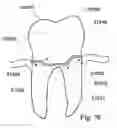 Fig. 49 - Methods of designing and manufacturing customized dental prosthesis for periodontal or osseointegration and related systems