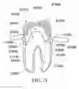 Fig. 50 - Methods of designing and manufacturing customized dental prosthesis for periodontal or osseointegration and related systems